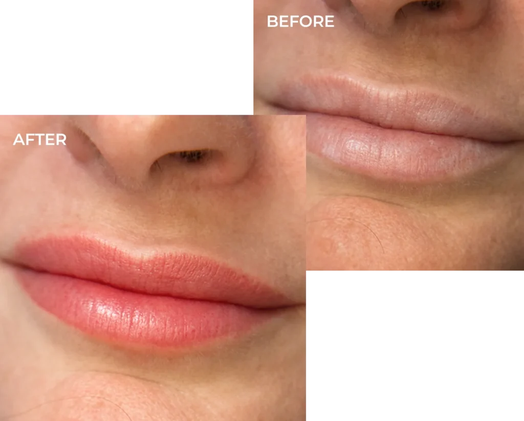 MBellish Lip Blush + Neutralization