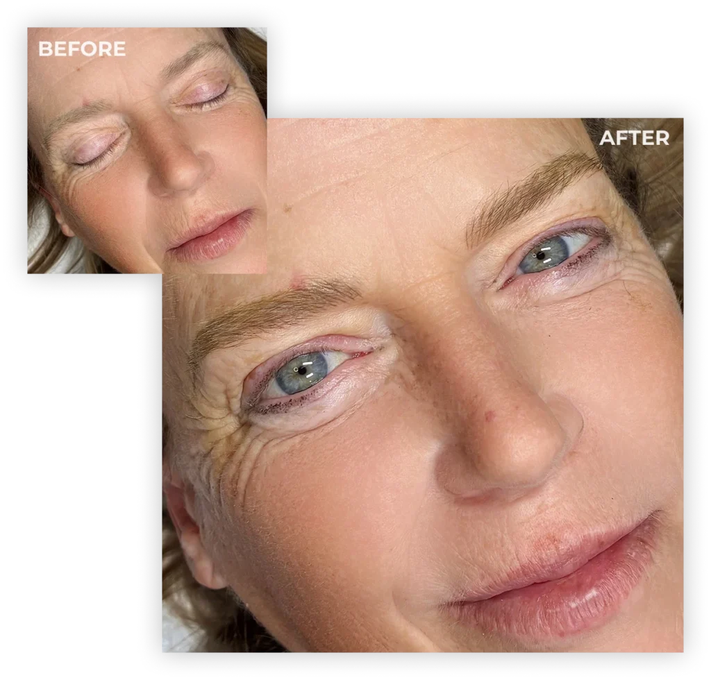 Mbellish Testimonial from Phyllis W.